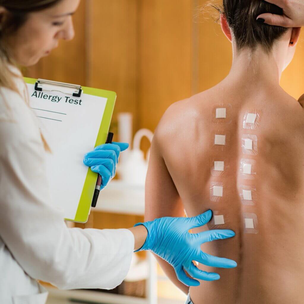 Allergy skin testing in Austin